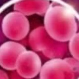 Lactococcus Lactis
